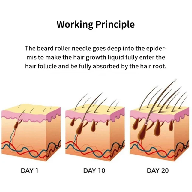 DRS 540 Dermaroller Men Beard Growth Derma Roller Men's Hair growth Nourishing Anti Hair Loss Black Microneedle roller 2
