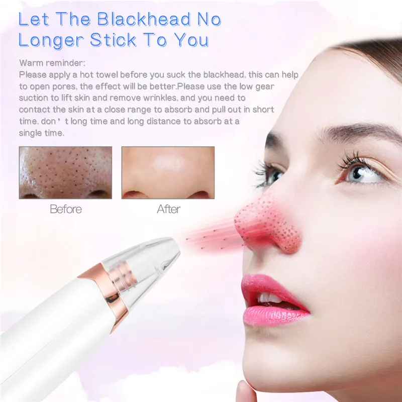 3 в 1 устройство для удаления угрей вакуумное всасывание уход за кожей лица акне