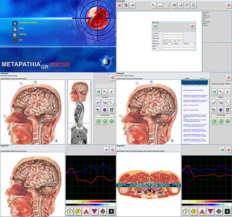 Body Magnetic Health  medical analyzer biochemistry for full body tests