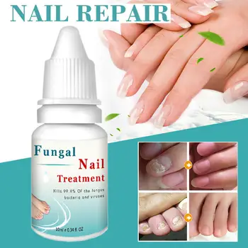 

Lanthome Fungal Liquid Nail Treatment Nail And Foot Whitening Toenail Fungu 10Ml