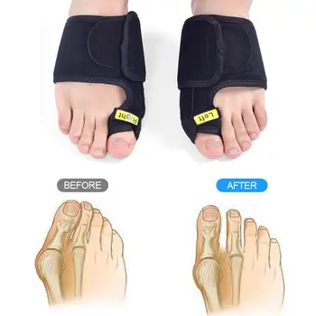 

Comfortable Velvet Black Getting Fix Fast Foot Tool Hallux Valgus Care Corrector Thumb Health Massage Strap Toe Orthotics Toes