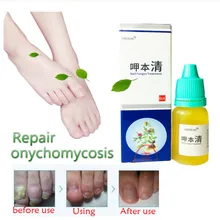 1/2 шт. Китайский травяной платырь против грибка ногтей с эфирным Лечение Уход за ногтями онихомикоз паронихии противогрибковые инфекция ногтей хороший результат