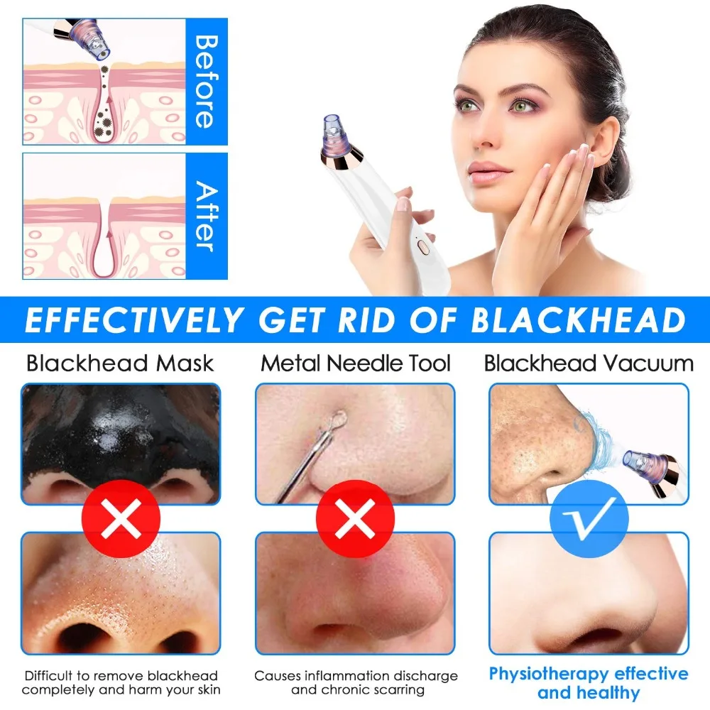 Blackhead Remover Pore Vacuum 5