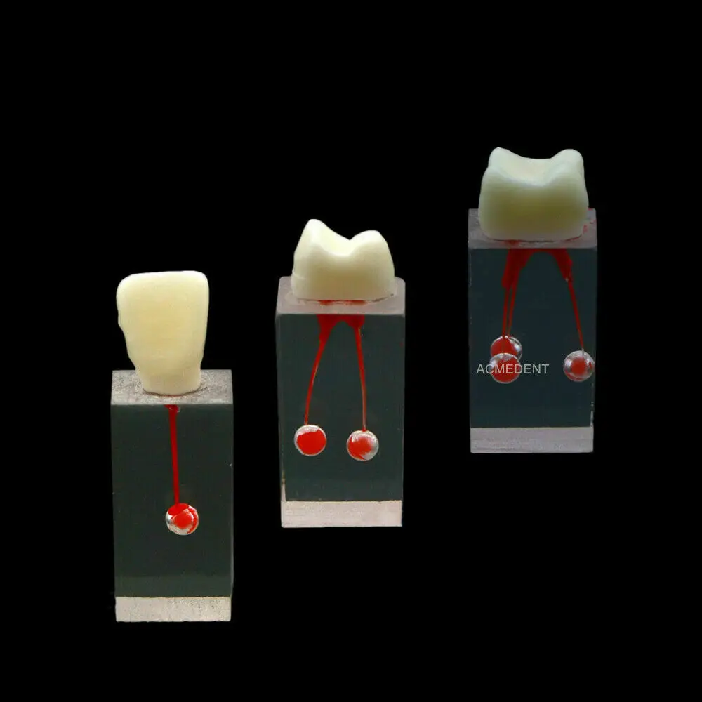 

3 типа, Стоматологическая модель, Эндодонтический блок корневого канала, для практики, корона, кабинет