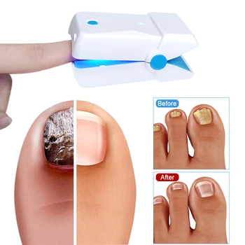

Nail Fungus Remover Home Use Laser Device, Safer, Quicker Results, Painless Therapy Treatment For Toes And Fingernails