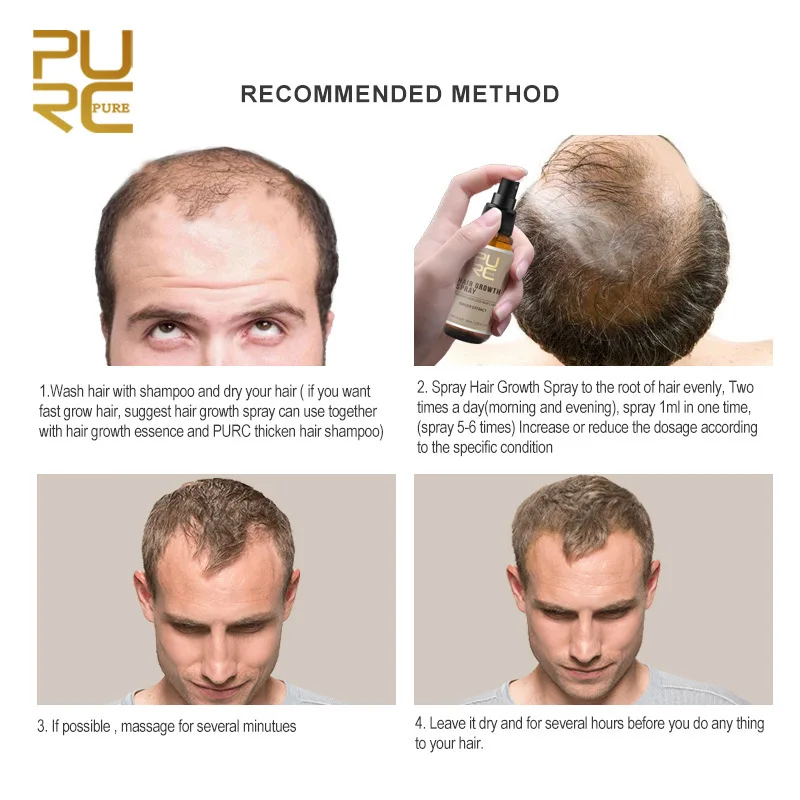 PURC Fashion 30ml Hair Growth Spray Extract Prevent Hair Loss Growing Hair For Men Ginger extract cure scalp growth TSLM1