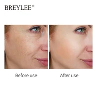 BREYLEE Retinol Face Sheet Mask Serum Moisturizing Anti-Aging Skin Care Fade Fine Lines Wrinkles Facial Mask Lifting Firming 1pc 2