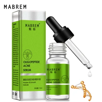 

Oligopeptide Acne Cleaning Lotion Serum Acne Treatment Cream Pore Repair Whitening Anti Anging Winkles Essence Moisturizing 10ML