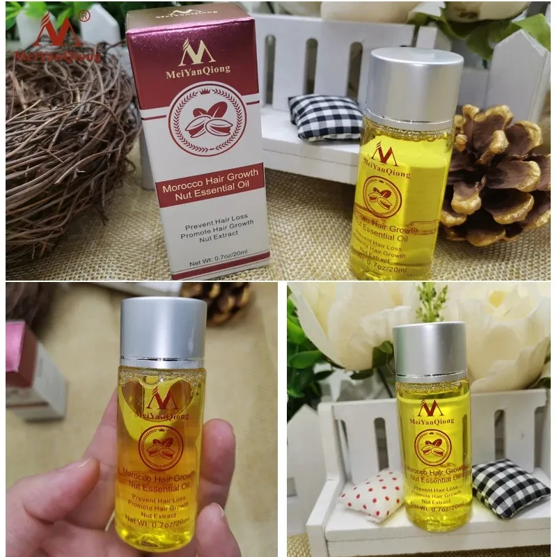 Crescita rapida Potenti prodotti essenziali Olio essenziale Trattamento liquido Prevenzione della perdita Cura dei capelli_voghion.com