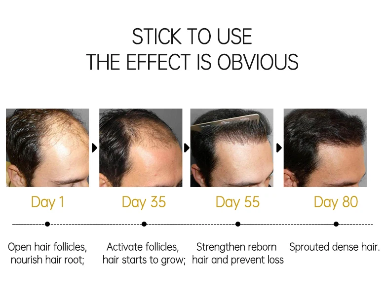 Hairinque Vitamin B7 Hair Growth Oil Prevent Hair Loss Serum Scalp