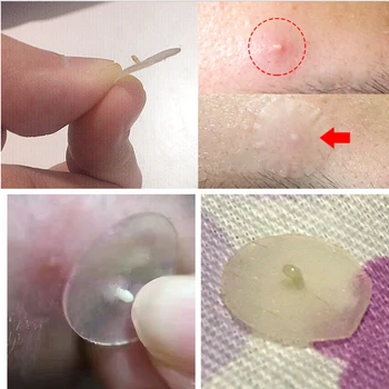 

Skin Care Facial Mask Sheet Invisible Acne Removal Pimple Patch Acne Treatment Stickers Fast Healing Suitable For Night