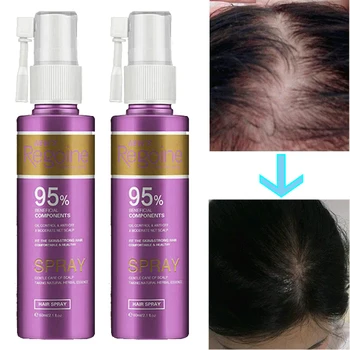 

55ml Hair Growth Treatment Oil Fast Thick Natural Anti Hair Loss Essence Products Repair Regrowth Women Hair Care Spray Serum