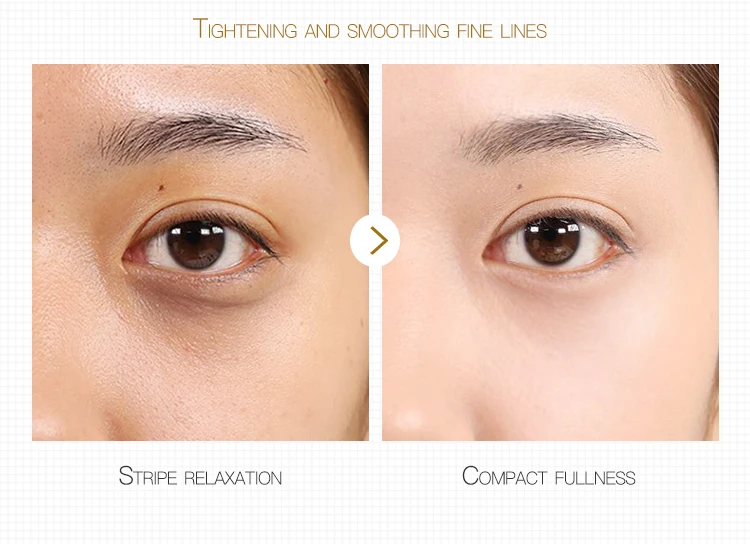 OEM HOUMAI moisturizing Anti Aging Anti-Wrinkle Dark Circles Remover Shrink pores face serum skin care