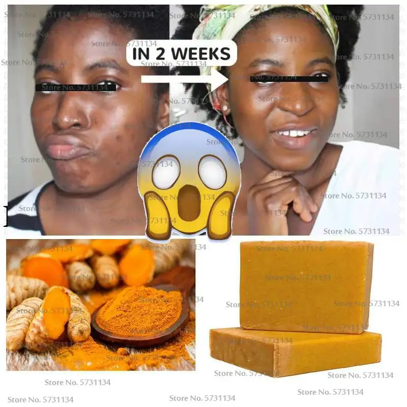 Tumeric Soap Natural. To Lightening Acne Dark Spots Skin Glow Brighter