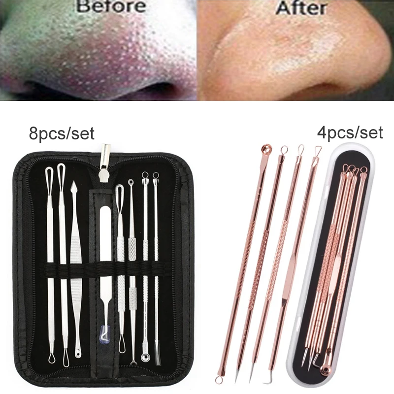 1 Набор инструментов для удаления чёрных точек прыщей и | Красота здоровье
