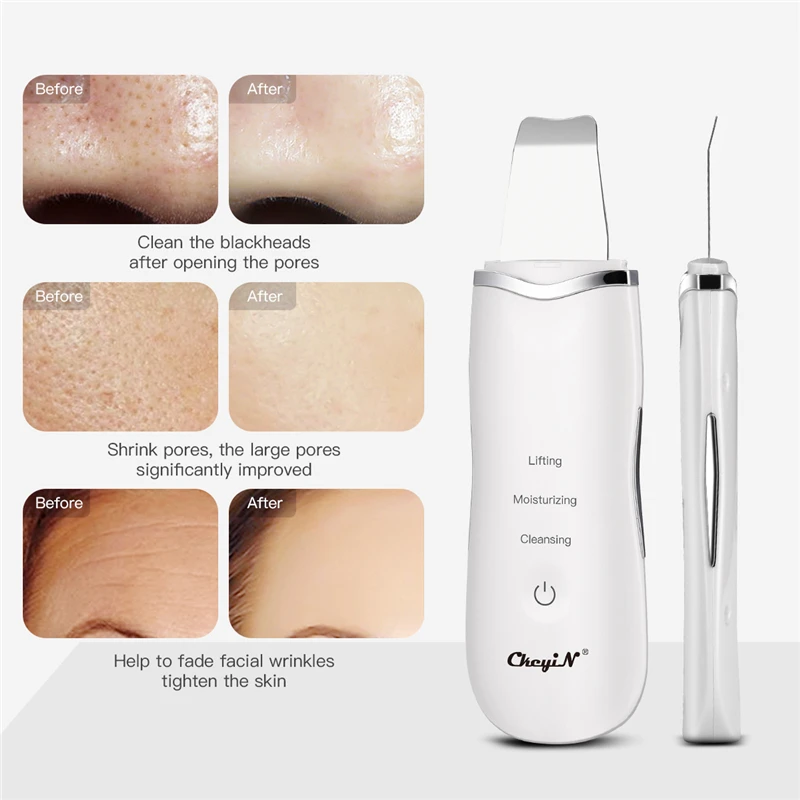EMS Mesotherapy RF Radio Frequency Facial Beauty Massager + Ultrasoic Skin Scrubber Deep Face Cleaning Nano Mister Face Sprayer