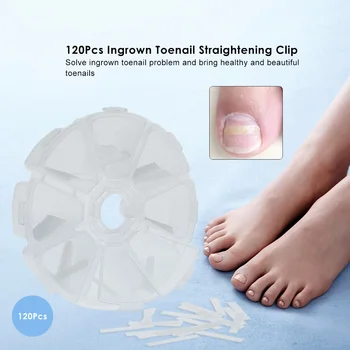

120Pcs Ingrown Toenail Straightening Clip Ingrown Toenail Correction Elastic Patches Paronychia Acronyx Correction Patch