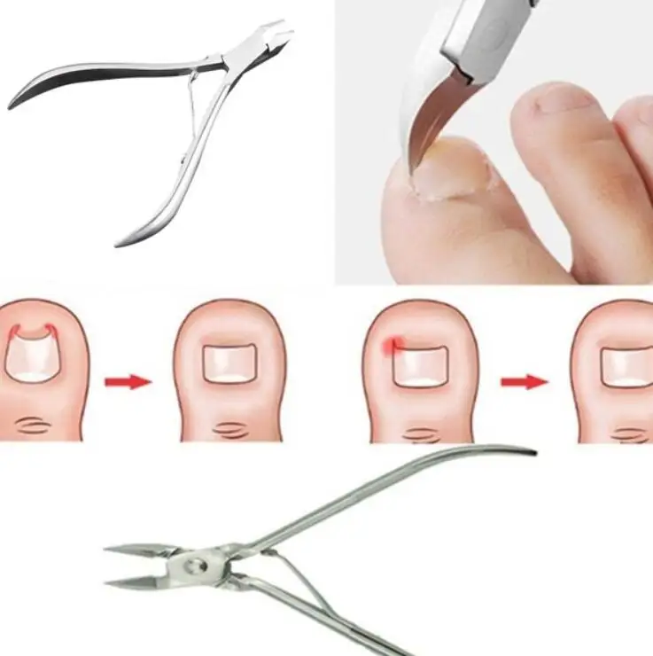 Ingrown Toenails Pedicure Foot Care Tool Nail Correction Clipper Cutters For Orthotic Acronyx Dead Skin Remover Podiatry