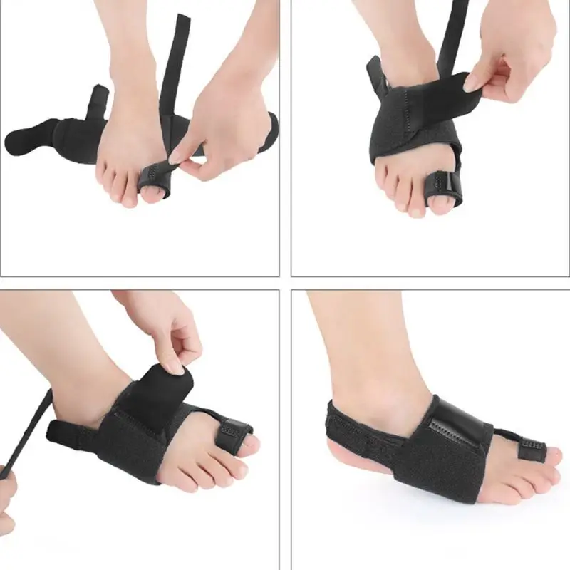 Bunion Splints корректор вальгусной деформации большого пальца ноги разделитель выпрямитель с сплава Strp корректор Bunion