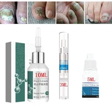 3/5/10 мл грибок ногтей лечение продукт средство от грибка ногтей онихомикоз паронихии анти-грибковая инфекция Китайский травяной