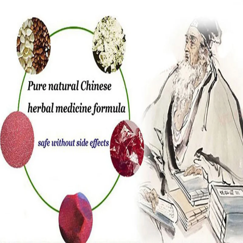 Chinese-Natrual-Material-Sterilize-Cream-Hemorrhoids-Ointment-Internal-Hemorrhoids-Piles-External-Anal-Fissure-Therapy-New