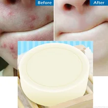 80g морской мыло с солью Удаление прыщей поры, акне Уход очиститель увлажняющий козье молоко уход за кожей лица Bady уход мыть основе мыло TSLM2