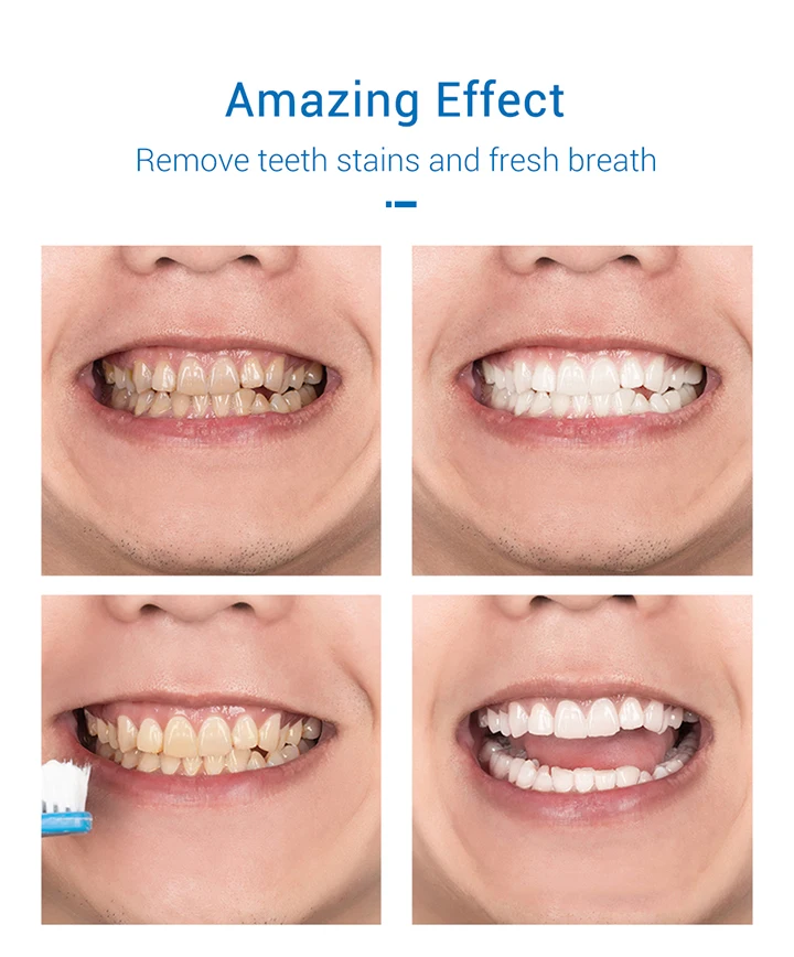 蓝蓓娜洁牙慕斯-详情19.8_06