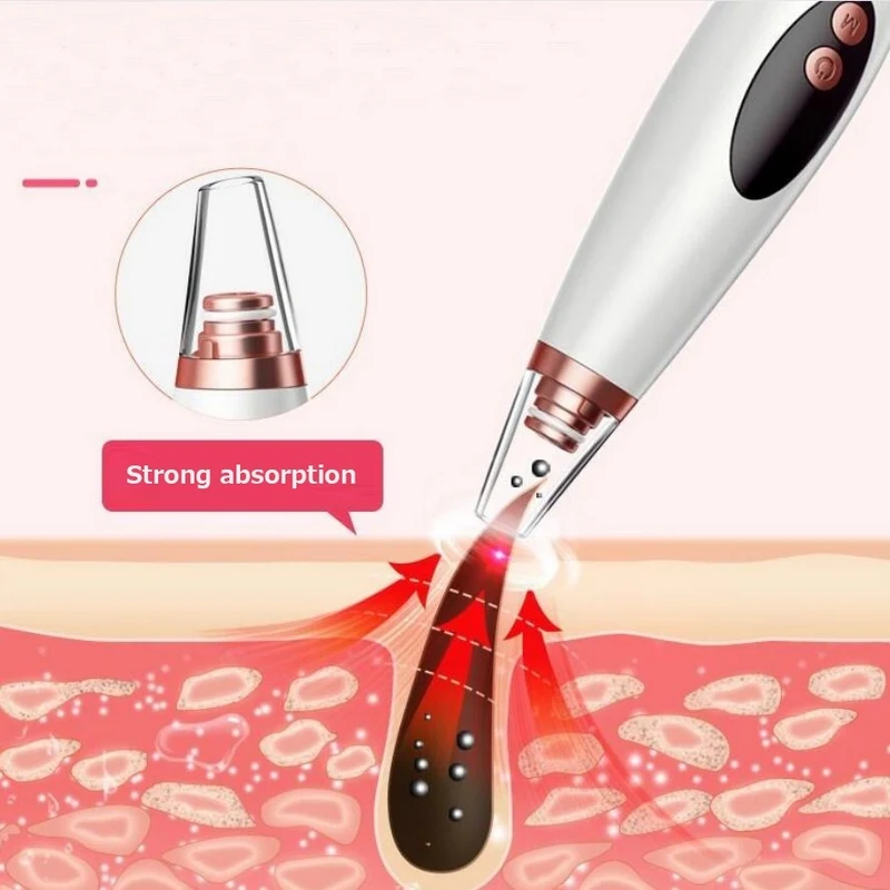 

Beauty Blackhead Remover Skin Care Tools Face Cleaner Products Face Pore Cleaner Against Black Dots Dropshipping Center Belleza