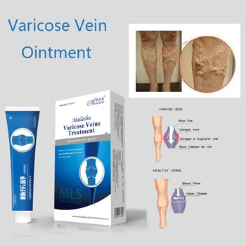 

Chinese natural herbal medicine for treating varicose vascular inflammation massage cream cure varicose vein ointment