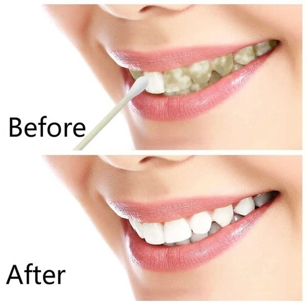 10ML Teeth Whitening Oral Hygiene Cleaning Oral Teeth Care Tooth Cleaning Whitening Water for Stains From Coffee Tea Removal