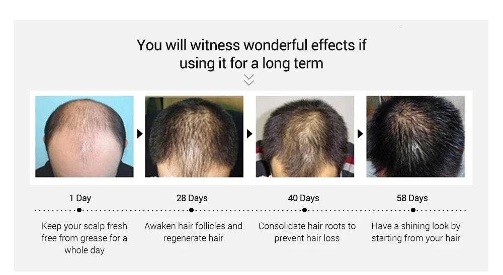LANBENA эфирное масло для роста волос быстрое мощное против выпадения волос Жидкое лечение для мужчин t Предотвращение выпадения волос для мужчин и женщин Уход за волосами