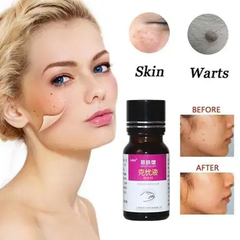 

10ML Genital Wart Treatment Papillomas Removal Of Warts Liquid From Skin Tags Removing Against Moles Remover Wart Removal Liuld