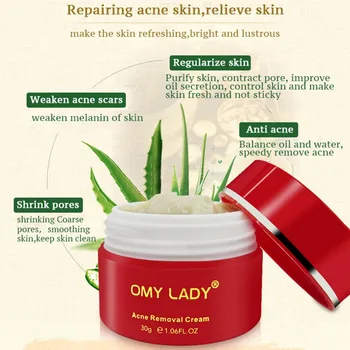 

Face Moisturizing Anti-Acne Cream Oil-Control Shrinking Pores Smoothing Skin Acne Treatment Cream