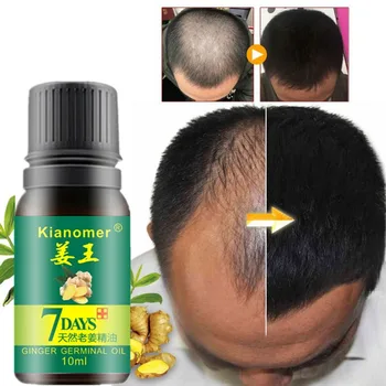 

Kianomer Ginger Hair Growth Essential Oil Nourish Hair Follicles Anti-hair Loss Hair Care Oil Hair & Scalp Treatments