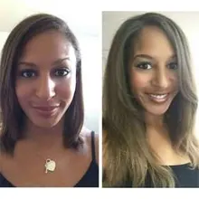 Crecimiento del cabello Aceites esenciales Esencia Anti Pérdida del cabello Productos Cuidado de la salud Belleza Crecimiento más rápido Crecimiento denso Cuidado del cabello Suero líquido