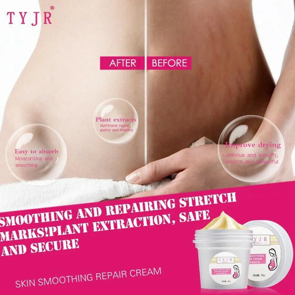 

35g Repair Marks Scars Cream Smoothing Skin Pregnancy Smooth Removal Cream Skin Mark Scar Cream Face Stretch Repair W7W0