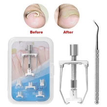 1 Набор для вросших ногтей, педикюра Уход за ногтями на ногах инструменты для нейл-арта для ног ортодический акрокс от вросших ноготей Onyxis Bunion корректор