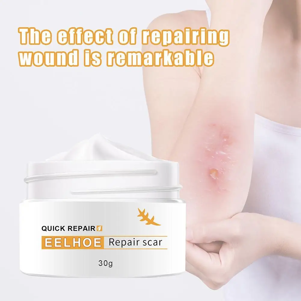 H6dd8dfaa68ae428f979e373d8822025cX Crocodile Repair Scar Face Cream Removal Acne Spots Whitening Skin for Scald and Surgical Scar Stretch Marks