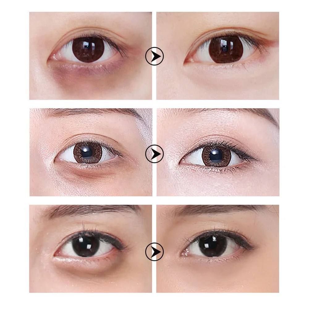 LANBENA Eye Mask Collagen Eye Patch Skin Care Hyaluronic Acid Gel Moisturizing Retinol Anti Aging Remove 1 LANBENA Eye Mask Collagen Eye Patch Skin Care Hyaluronic Acid Gel Moisturizing Retinol Anti Aging Remove 2