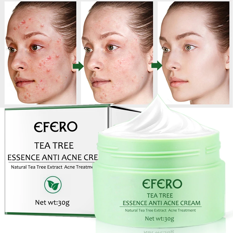 Tea Tree Anti Acne Treatment Face Cream Whitening Moisturizing Cream Shrink Pores Oil Control Anti Aging 4