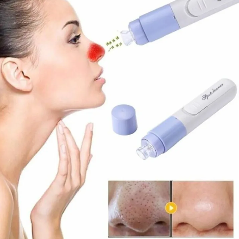 

Mini Electric Facial Pore Blackhead Removers Skin Care Tool Cleanser Vacuum Face Dirt Suck Up Acne Pimple Remover Clean Tools