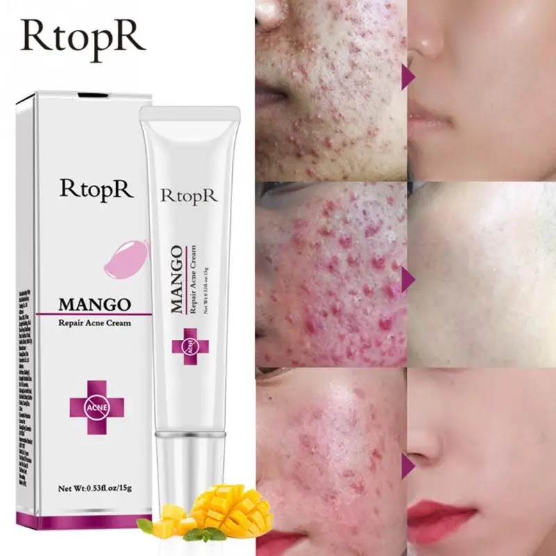 

15g/ml Multifunction Face Care Anti Stain Moisturizing Hydrating Skin Tool Smooth Acne Cream Treatment Repair Scar Removal