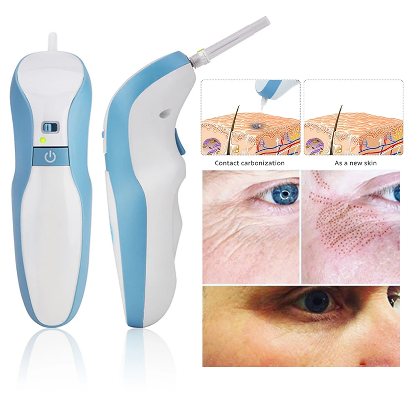 Plasma pen Home use Eyelid Lift Wrinkle Skin lifting Tattoo Mole Removal Pen Beauty Medical Spot | Красота и здоровье