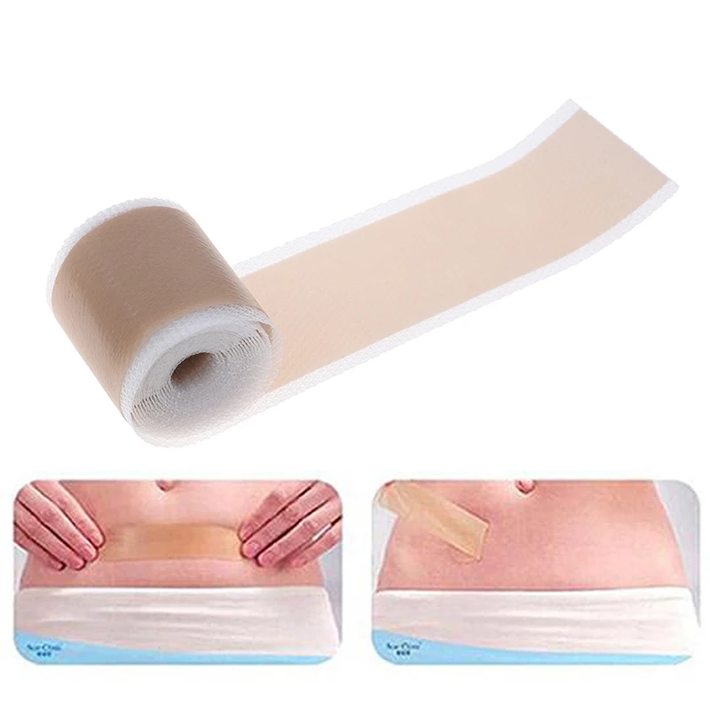 Efficient Surgery Scar Removal Silicone Gel Sheet Therapy Patch for Acne Trauma Burn Scar Skin Repair Treatment 3 Sizes