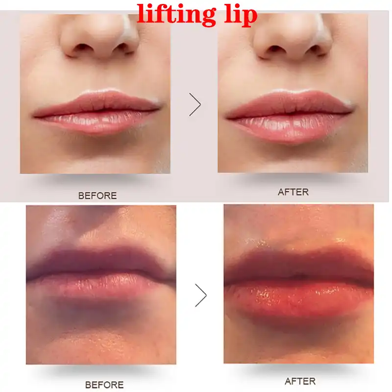 High Pressure Hyaluronic Acid Pen Beauty Tool Hyaluron Pen for Anti