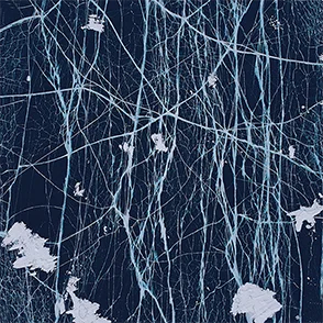 pattern 17 Пончики Универсальный телефон растягивающийся кронштейн мультфильм телефон расширяющийся стенд палец кольцо - Цвет: pattern 17