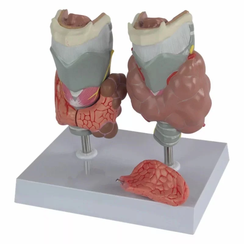 Modèle anatomique médical de thyroïde pathologie larynx ...