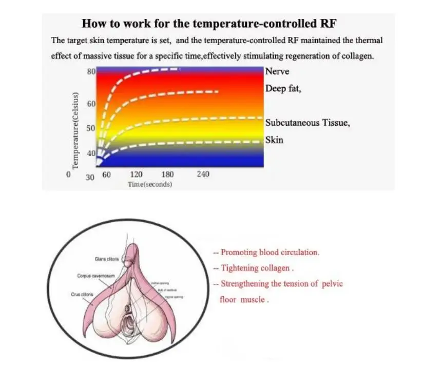 soldering stations RF radio frequency thermiva vaginal tightening machine women private care thermi vagina rejuvenation spa salon beauty equipment inverter arc welder