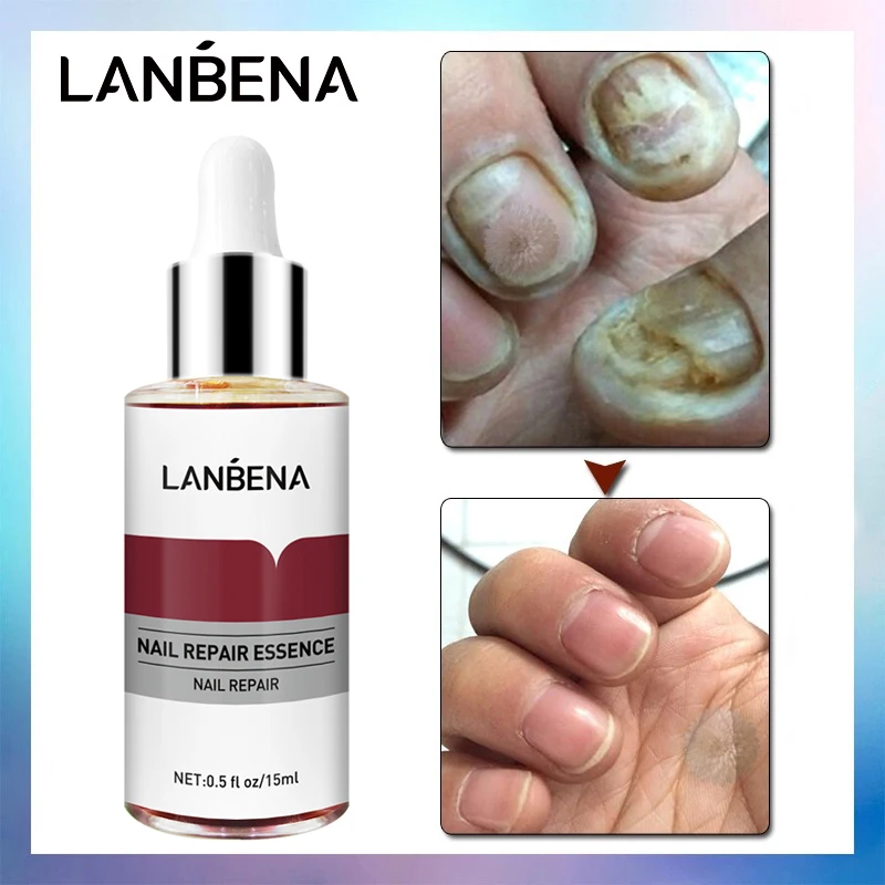 Эссенция LANBENA для восстановления ногтей сыворотка лечения грибковых удаление