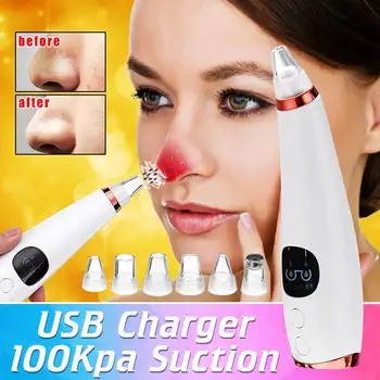 

Electric Facial Pore Cleanser Face Blackhead Vacuum Acne Remover Skin Cleaner